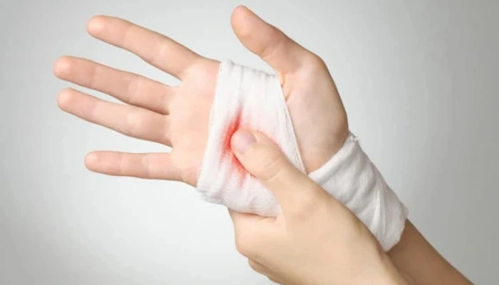 Cách Sơ Cứu Khi Bị Chảy Máu Nhiều – Đúng và An Toàn