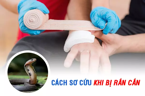 Cách Sơ Cứu Người Bị Rắn Cắn – Xử Lý Kịp Thời, Giảm Nguy Cơ Tử Vong