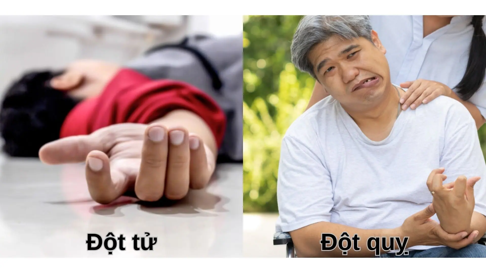 Phân Biệt Đột Quỵ Và Đột Tử | Hướng Dẫn Sơ Cứu Đúng Cách